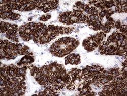 HADH Mouse anti-Human, Clone: UMAB151, liquid, UltraMAB 30 &mu;L; Unconjugated:Antibodies,