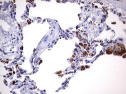 HADH Mouse anti-Human, Clone: UMAB151, liquid, UltraMAB 30 &mu;L; Unconjugated:Antibodies,