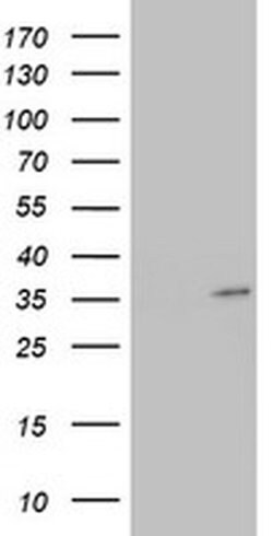 HADH Monoclonal Antibody (OTI1D8), TrueMAB , OriGene 100 &mu;L | Buy Online | Origene Technologies | Fisher Scientific