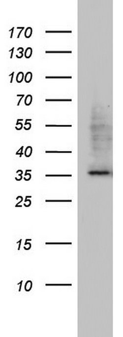 HADH Monoclonal Antibody (OTI1D8), TrueMAB , OriGene 100 &mu;L | Buy Online | Origene Technologies | Fisher Scientific
