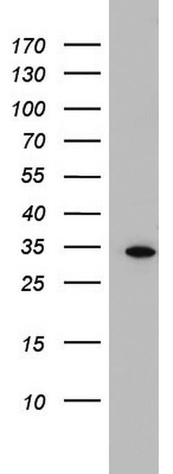 HADH Monoclonal Antibody (OTI7C9), TrueMAB , OriGene:Antibodies:Primary