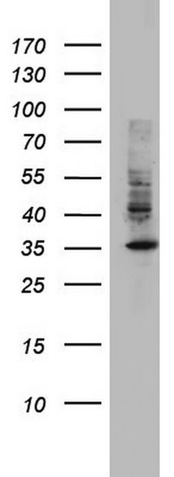 HADH Monoclonal Antibody (OTI6F10), TrueMAB , OriGene:Antibodies:Primary