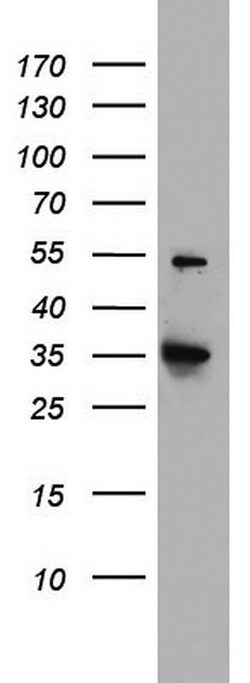 HADH Mouse anti-Human, Clone: OTI3D12, lyophilized, TrueMAB 100 &mu;g;