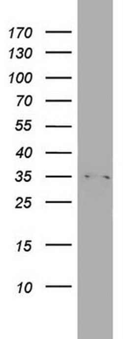 HADH Monoclonal Antibody (OTI3F11), TrueMAB , OriGene 30 &mu;L; Unconjugated:Antibodies,