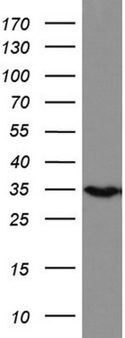 HADH Mouse anti-Human, Clone: UMAB151, liquid, UltraMAB 30 &mu;L; Unconjugated:Antibodies,