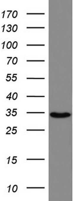 HADH Mouse anti-Human, Clone: UMAB151, liquid, UltraMAB 30 &mu;L; Unconjugated:Antibodies,
