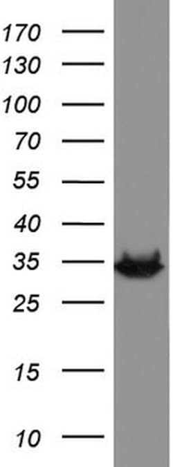 HADH Mouse anti-Human, Clone: UMAB151, lyophilized, UltraMAB 100 &mu;g;