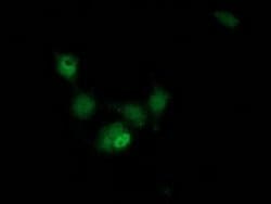 HAGHL Monoclonal Antibody (OTI1G8), TrueMAB , OriGene 100 &mu;L; Unconjugated:Antibodies,