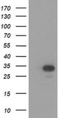 HAGHL Monoclonal Antibody (OTI4G10), TrueMAB , OriGene 30 &mu;L | Buy Online | Origene Technologies | Fisher Scientific