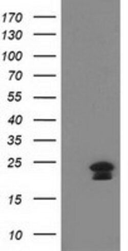 HAND1 Mouse anti-Human, Clone: OTI1G10, lyophilized, TrueMAB 100 &mu;g;