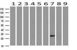 HAND1 Mouse anti-Human, Clone: OTI1G10, lyophilized, TrueMAB 100 &mu;g;