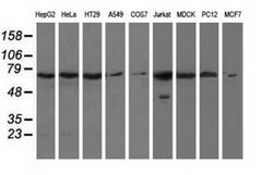 HAO1 Monoclonal Antibody (OTI3E7), TrueMAB , OriGene:Antibodies:Primary