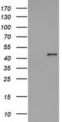 HAO1 Monoclonal Antibody (OTI5F4), TrueMAB , OriGene 100 &mu;L; Unconjugated:Antibodies,