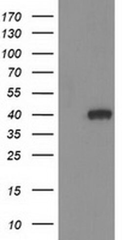 HAO1 Monoclonal Antibody (OTI6B3), TrueMAB , OriGene 100 &mu;L; Unconjugated:Antibodies,
