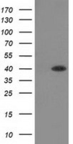 HAO1 Mouse anti-Canine, Human, Rat, Clone: OTI5C3, lyophilized, TrueMAB