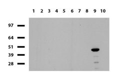 HAO1 Mouse anti-Human, Clone: UMAB117, liquid, UltraMAB 30 &mu;L; Unconjugated:Antibodies,