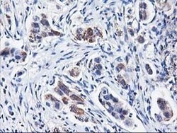 HARS2 Monoclonal Antibody (OTI2D6), TrueMAB , OriGene 30 &mu;L; Unconjugated:Antibodies,