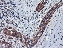 HARS2 Monoclonal Antibody (OTI2D6), TrueMAB , OriGene:Antibodies:Primary