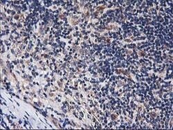 HARS2 Monoclonal Antibody (OTI2D6), TrueMAB , OriGene 30 &mu;L; Unconjugated:Antibodies,