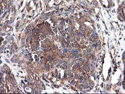 HARS2 Monoclonal Antibody (OTI3F1), TrueMAB , OriGene 100 &mu;L; Unconjugated:Antibodies,