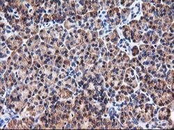 HARS2 Mouse anti-Human, Clone: OTI3F1, lyophilized, TrueMAB 100 &mu;g;