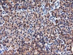 HARS2 Monoclonal Antibody (OTI3F1), TrueMAB , OriGene 100 &mu;L; Unconjugated:Antibodies,