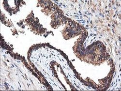 HARS2 Monoclonal Antibody (OTI3F1), TrueMAB , OriGene 100 &mu;L; Unconjugated:Antibodies,