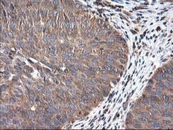 HARS2 Monoclonal Antibody (OTI3F1), TrueMAB , OriGene 100 &mu;L; Unconjugated:Antibodies,