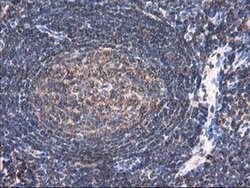 HARS2 Monoclonal Antibody (OTI3F1), TrueMAB , OriGene 100 &mu;L; Unconjugated:Antibodies,