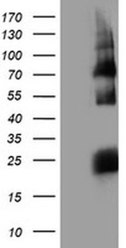 HARS2 Monoclonal Antibody (OTI2D6), TrueMAB , OriGene:Antibodies:Primary