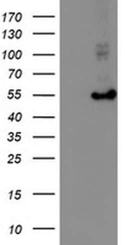 HARS2 Monoclonal Antibody (OTI5H2), TrueMAB , OriGene 100 &mu;L; Unconjugated:Antibodies,