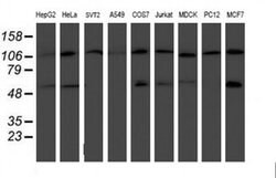 HARS2 Monoclonal Antibody (OTI5H2), TrueMAB , OriGene 100 &mu;L; Unconjugated:Antibodies,