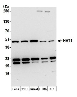 HAT1/KAT1 Polyclonal Antibody, Bethyl Laboratories 20 &mu;L; Unconjugated:Antibodies,