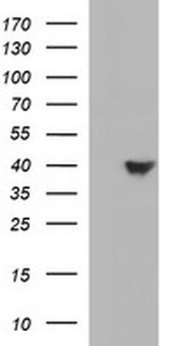 HAUS7 Monoclonal Antibody (OTI2E9), TrueMAB , OriGene 100 &mu;L | Buy Online | Origene Technologies | Fisher Scientific