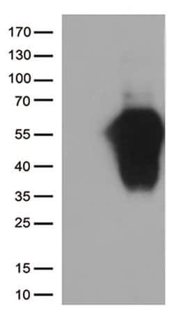 HAVCR2 Monoclonal Antibody (OTI12C5), TrueMAB , OriGene 30 &mu;L; Unconjugated:Antibodies,