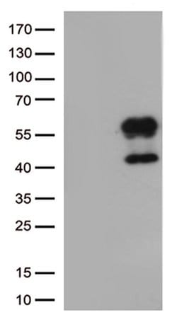 HAVCR2 Monoclonal Antibody (OTI1D6), TrueMAB , OriGene 100 &mu;L; Unconjugated:Antibodies,