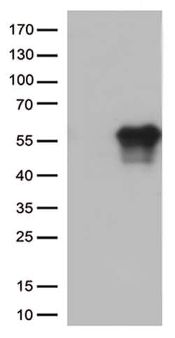 HAVCR2 Monoclonal Antibody (OTI1G9), TrueMAB , OriGene:Antibodies:Primary