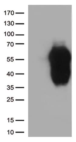 HAVCR2 Monoclonal Antibody (OTI2E5), TrueMAB , OriGene 100 &mu;L; Unconjugated:Antibodies,