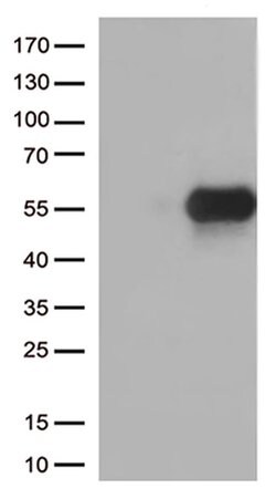 HAVCR2 Monoclonal Antibody (OTI1C4), TrueMAB , OriGene:Anticuerpos:Anticuerpos