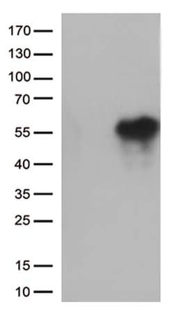 HAVCR2 Monoclonal Antibody (OTI2B9), TrueMAB , OriGene 100 &mu;L; Unconjugated:Antibodies,