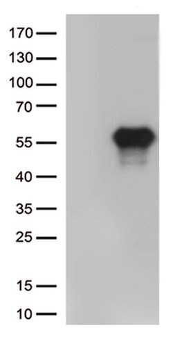HAVCR2 Monoclonal Antibody (OTI1D10), TrueMAB , OriGene 100 &mu;L; Unconjugated:Antibodies,