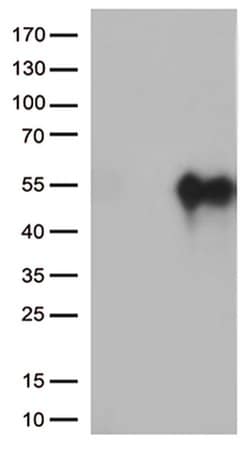 HAVCR2 Monoclonal Antibody (OTI13B10), TrueMAB , OriGene 30 &mu;L; Unconjugated:Anticuerpos