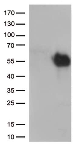 HAVCR2 Monoclonal Antibody (OTI2E11), TrueMAB , OriGene 100 &mu;L; Unconjugated:Antibodies,
