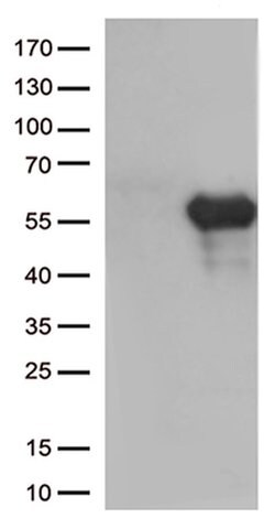 HAVCR2 Monoclonal Antibody (OTI4B2), TrueMAB , OriGene 100 &mu;L; Unconjugated:Antibodies,