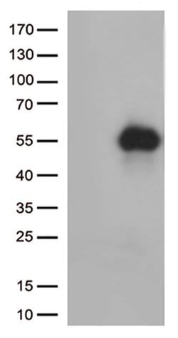 HAVCR2 Monoclonal Antibody (OTI7B10), TrueMAB , OriGene 100 &mu;L; Unconjugated:Antibodies,