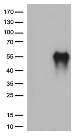 HAVCR2 Monoclonal Antibody (OTI13A8), TrueMAB , OriGene 100 &mu;L; Unconjugated:Antibodies,