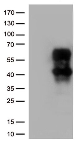 HAVCR2 Monoclonal Antibody (OTI9H6), TrueMAB , OriGene:Antibodies:Primary