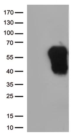 HAVCR2 Monoclonal Antibody (OTI2F11), TrueMAB , OriGene 100 &mu;L; Unconjugated:Antibodies,
