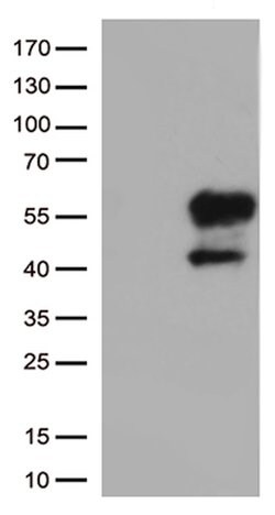 HAVCR2 Mouse anti-Human, Clone: OTI4E4, lyophilized, TrueMAB 100 &mu;g;