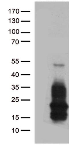 HBEGF Monoclonal Antibody (OTI10A4), TrueMAB , OriGene 100 &mu;L; Unconjugated:Antibodies,